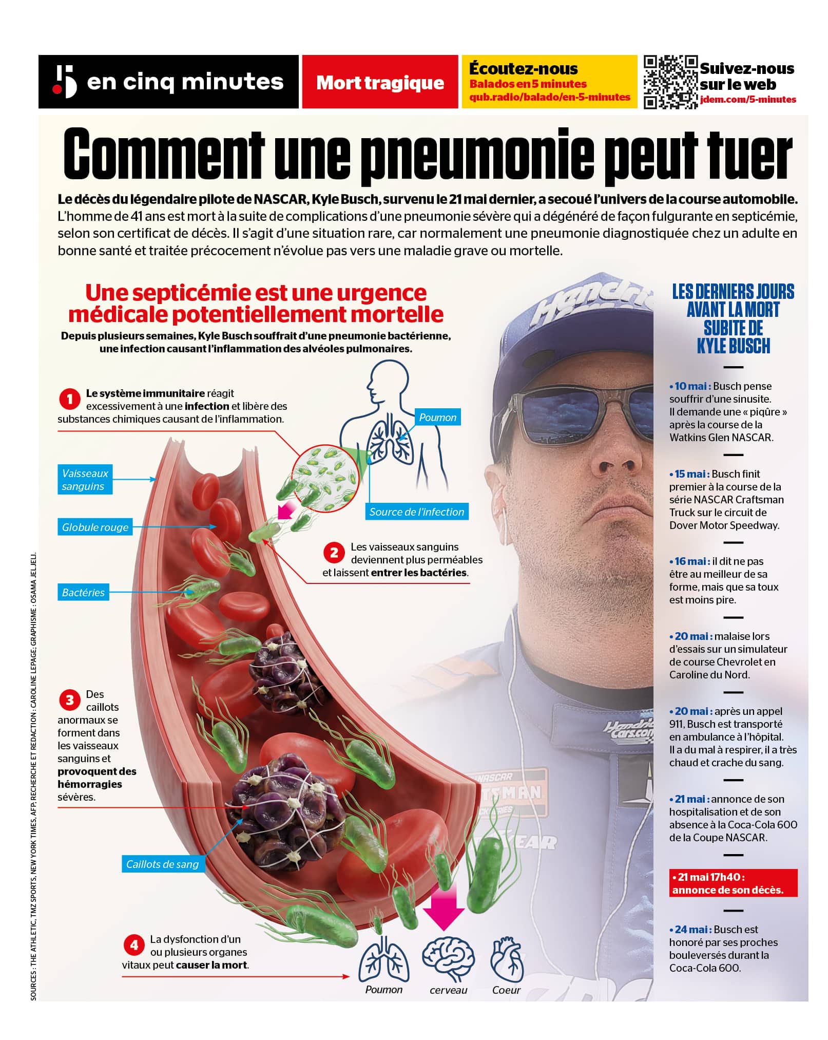 INFOGRAPHIE | Mort de Kyle Busch: quand une pneumonie dégénère en septicémie