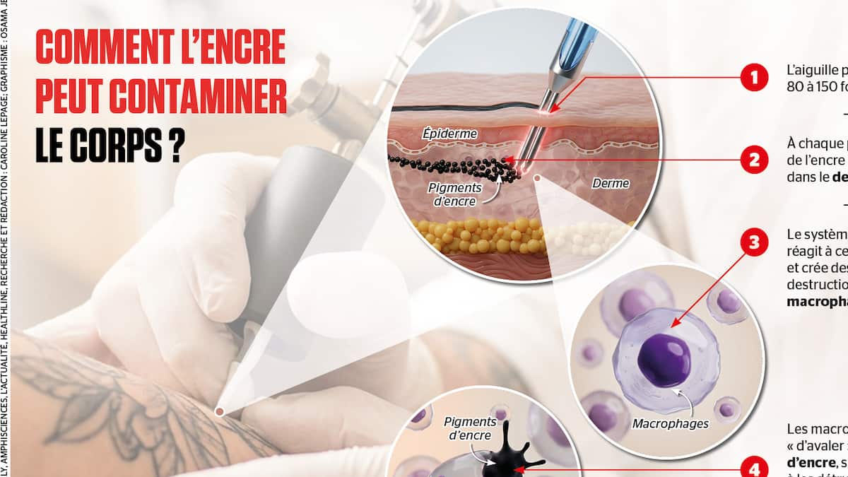 Tatouages: Les risques pour la santé, une étude internationale