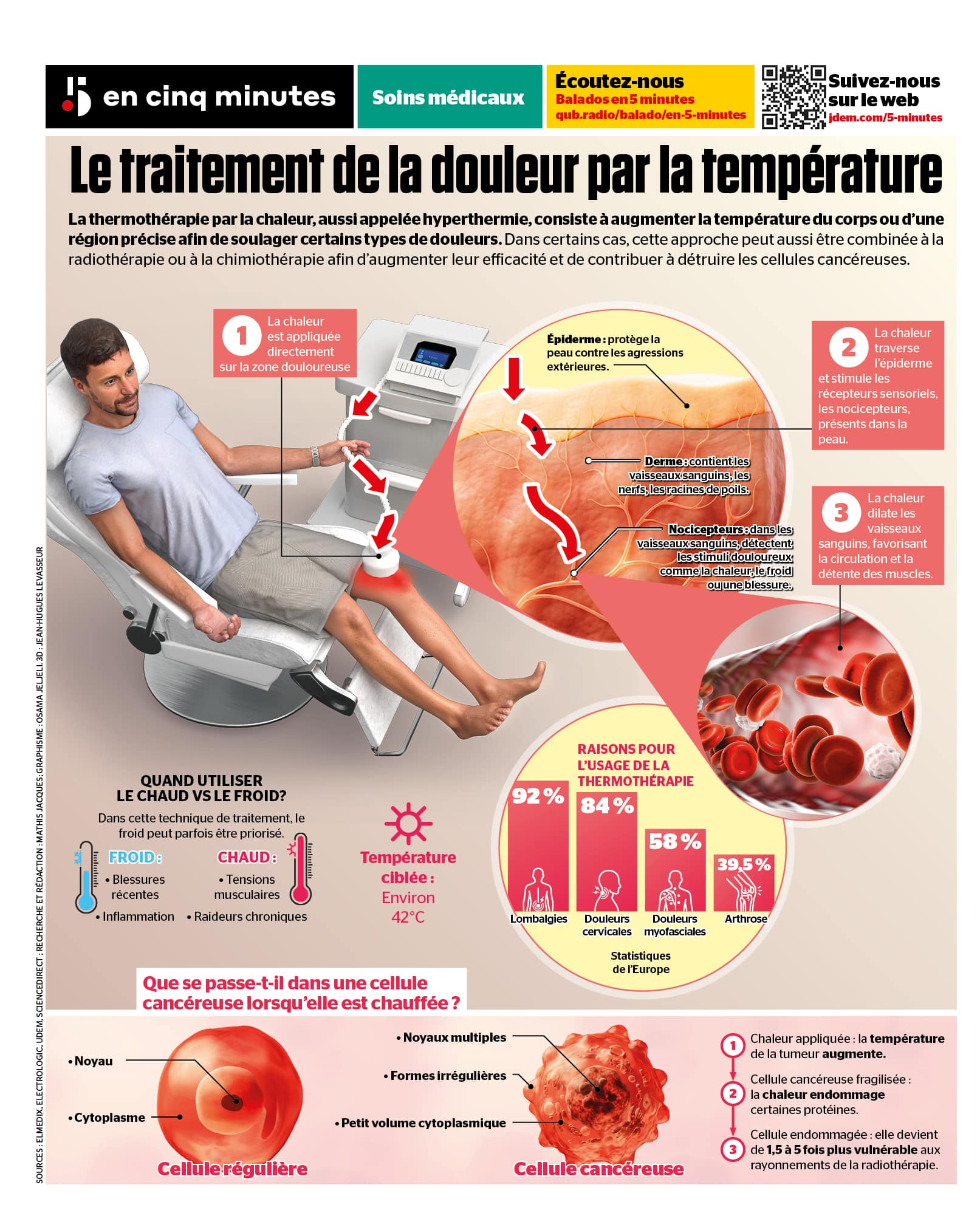 INFOGRAPHIE | Thermothérapie:  le traitement de la douleur par la température