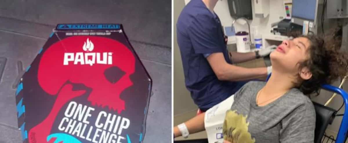 Eating ultra-spicy chips, this challenge sends teenagers to the hospital Eating ultra-spicy chips, this challenge sends teenagers to the hospital