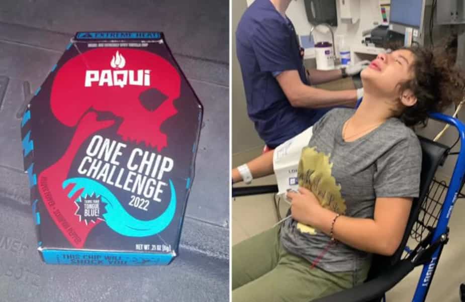 Image principale de l'article Une chip très épicée envoie des jeunes à l'hôpital