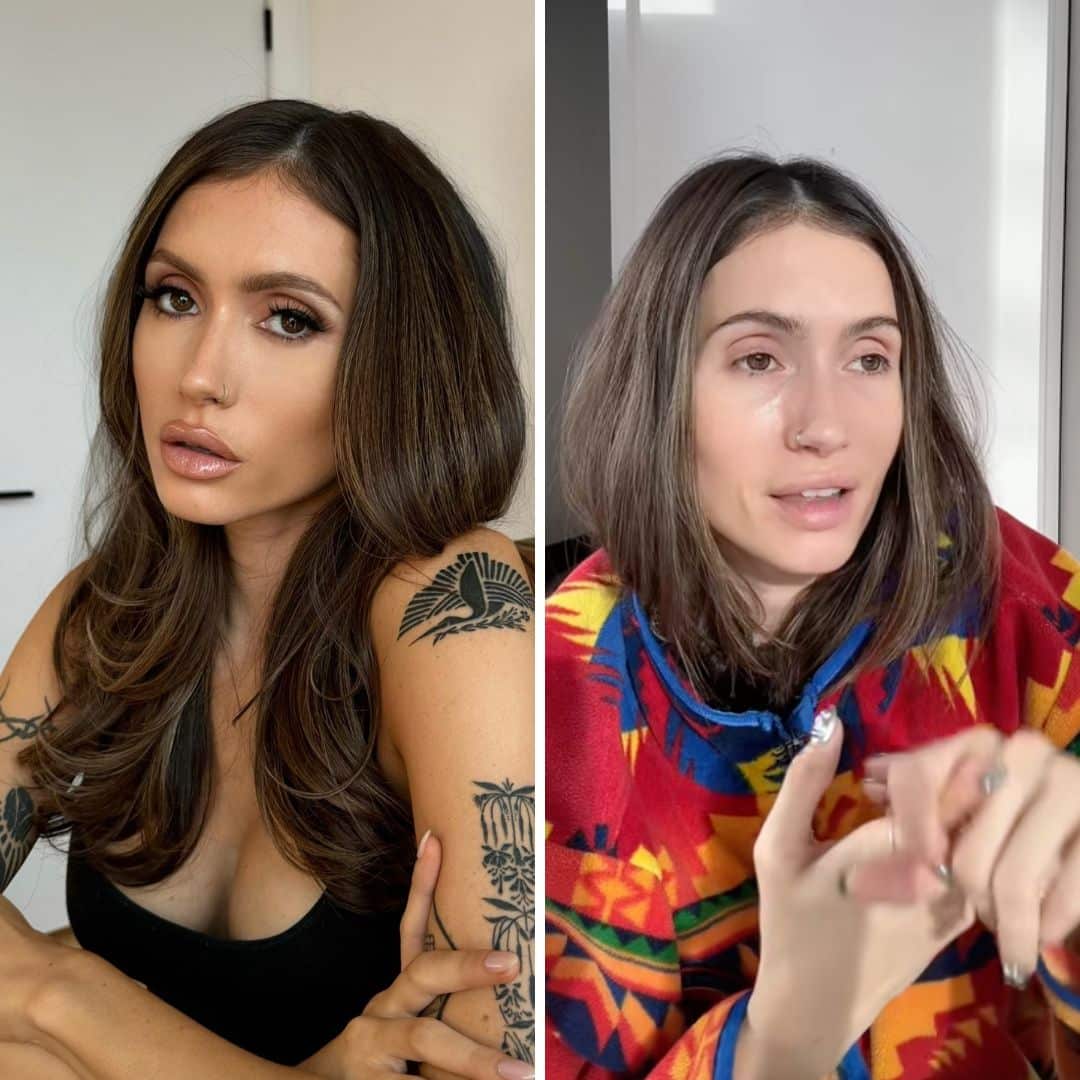 Son diagnostic détaillé dans un TikTok contesté