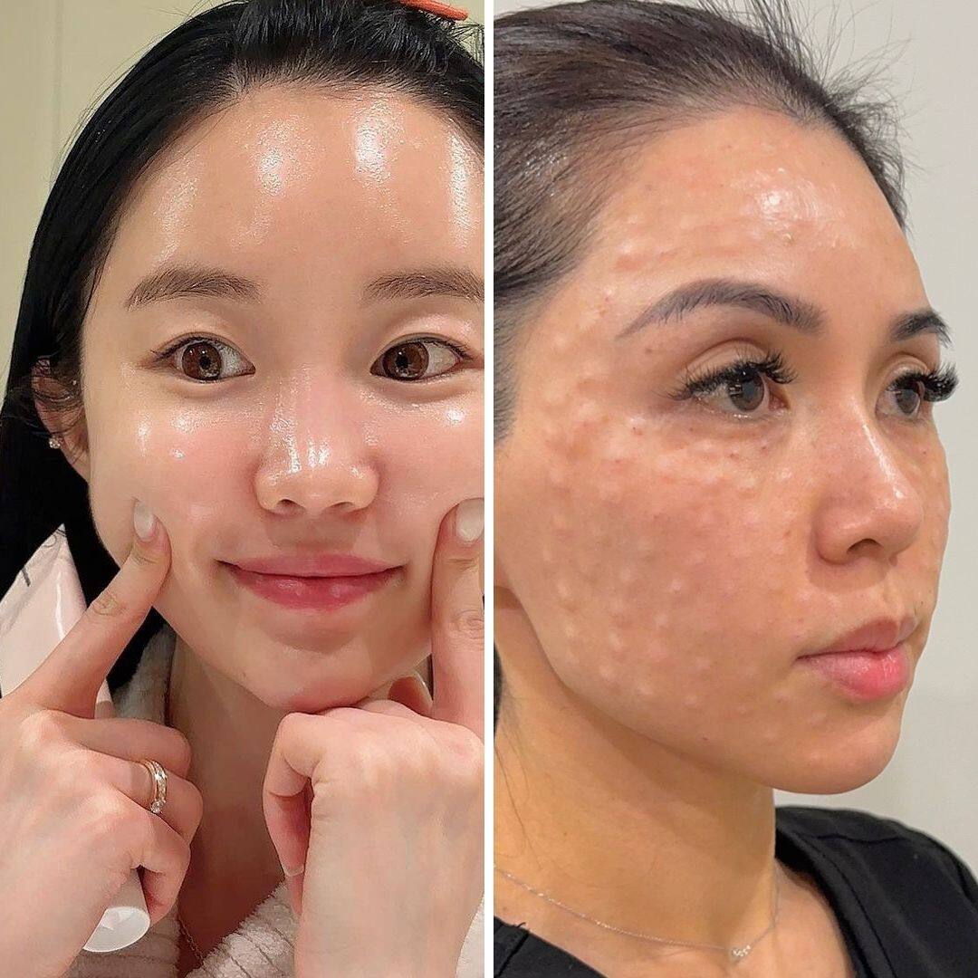 Ce produit viral serait miraculeux, mais dégoûtant