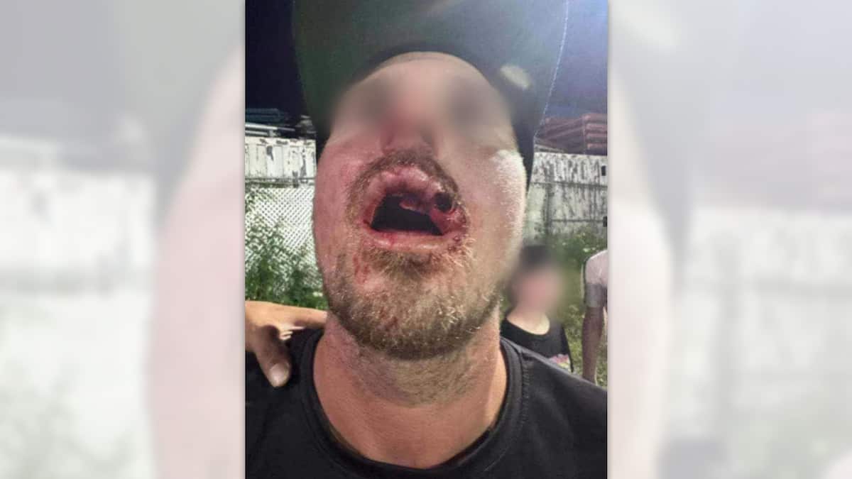 Un arbitre de dek hockey agressé à coups de bâton par un joueur