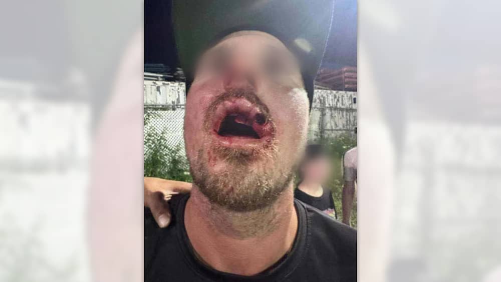 Un arbitre de dek hockey agressé à coups de bâton par un joueur