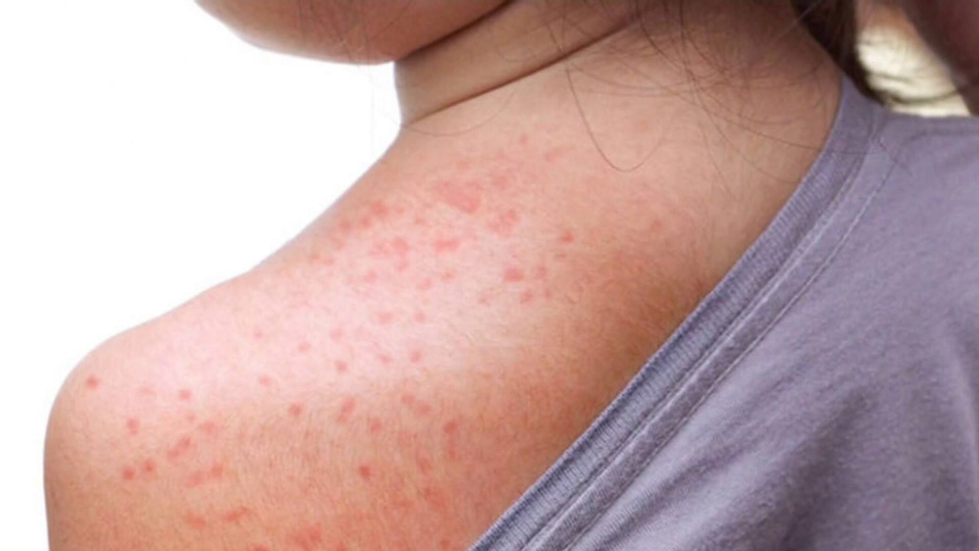 Un virologue appelle à la prudence