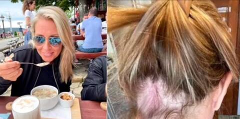 Olaplex: Customers complain of hair loss and burns