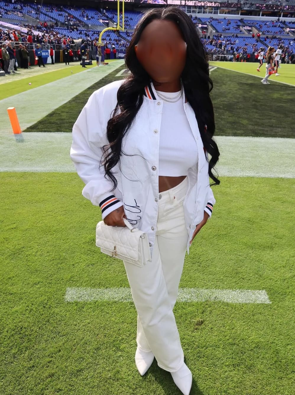 Pourquoi les stars revendiquent leurs chirurgies?