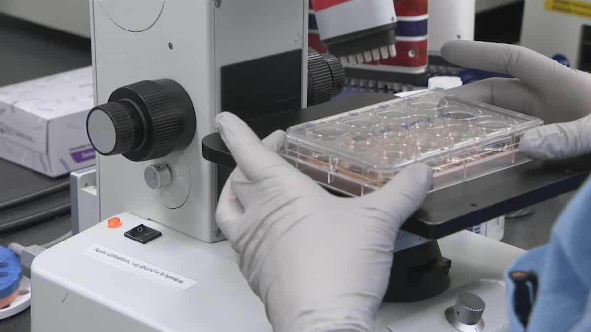 Les techniciens de laboratoire à bout de souffle  TVA Nouvelles