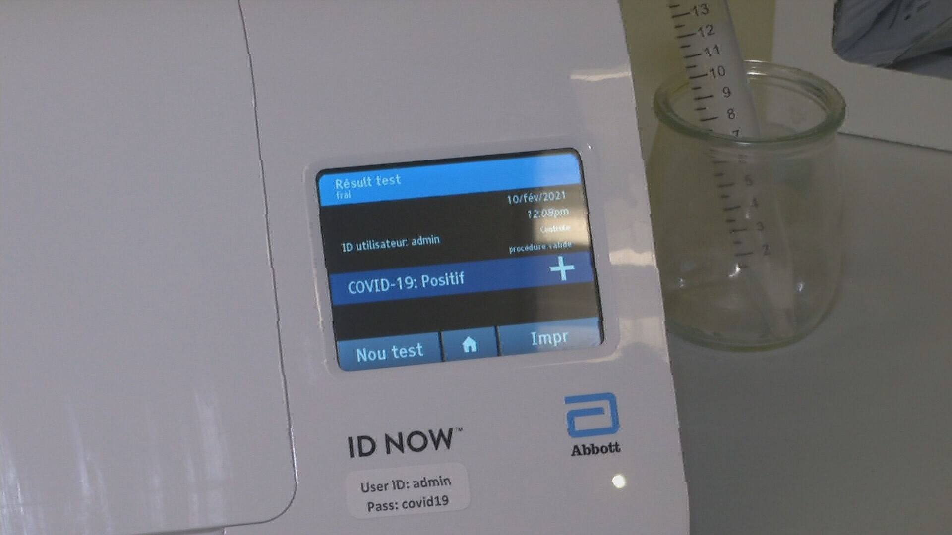 Coronavirus (COVID-19) causes you to lose IQ points