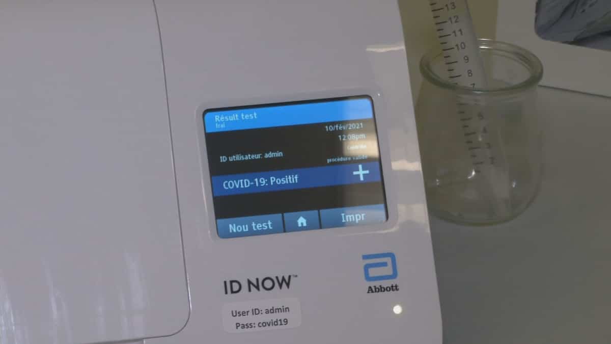 Coronavirus (COVID-19) causes you to lose IQ points Coronavirus (COVID-19) causes you to lose IQ points