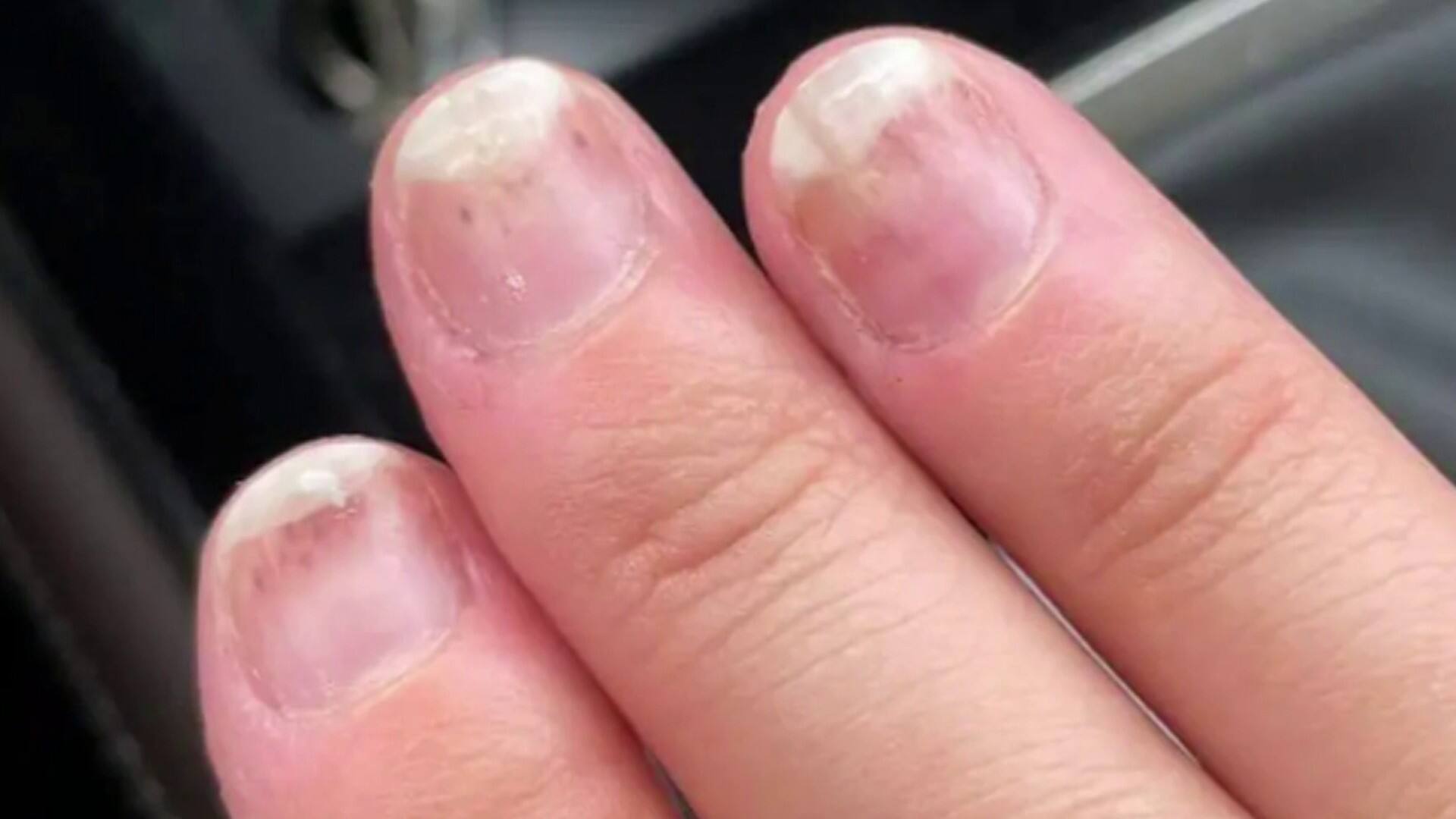 Un vernis dans la mire de santé Canada