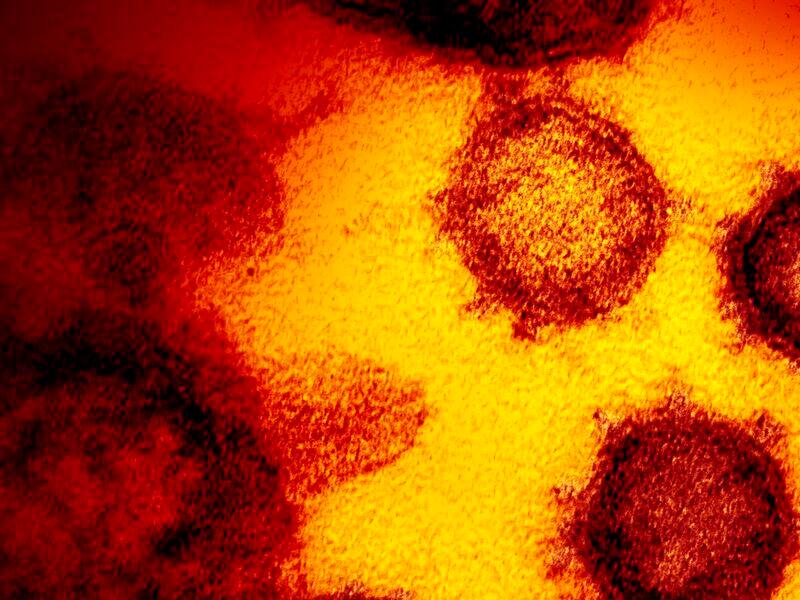 Ce que vous devez savoir sur le coronavirus (COVID-19) Ce que vous devez savoir sur le coronavirus (COVID-19)