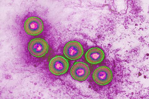 Strange viruses, including herpes, discovered on the surface of oceans and seas