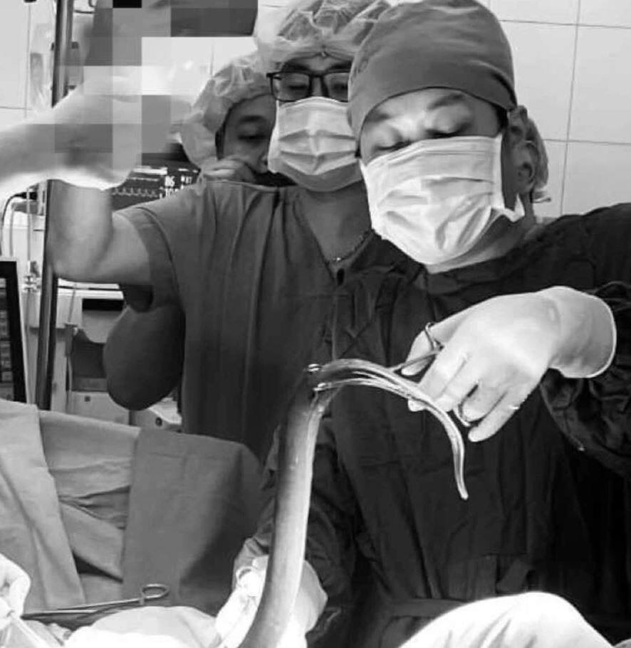 Un homme hospitalis&eacute; apr&egrave;s s&rsquo;&ecirc;tre rentr&eacute; une anguille vivante de 65 cm dans le post&eacute;rieur