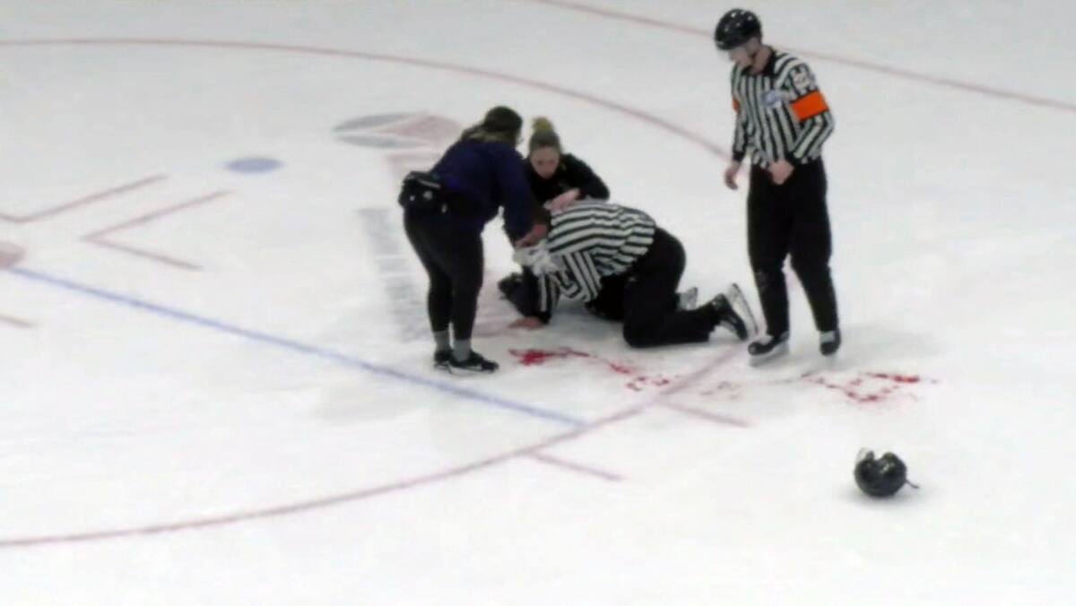 Un arbitre reçoit une rondelle en plein visage