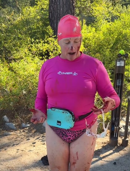 American Swimmer Receives Dozens of Stitches After River Otter Attack - News Directory 3