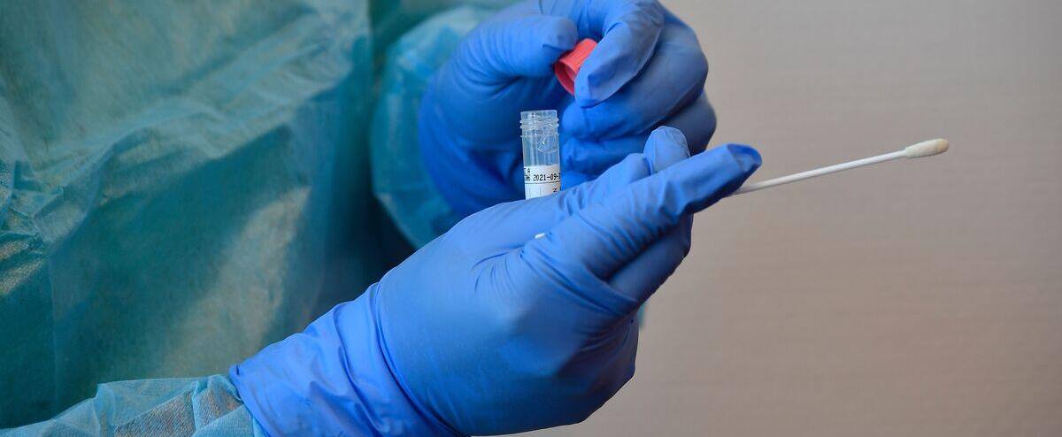 COVID-19: the top of the second wave already in sight? 1