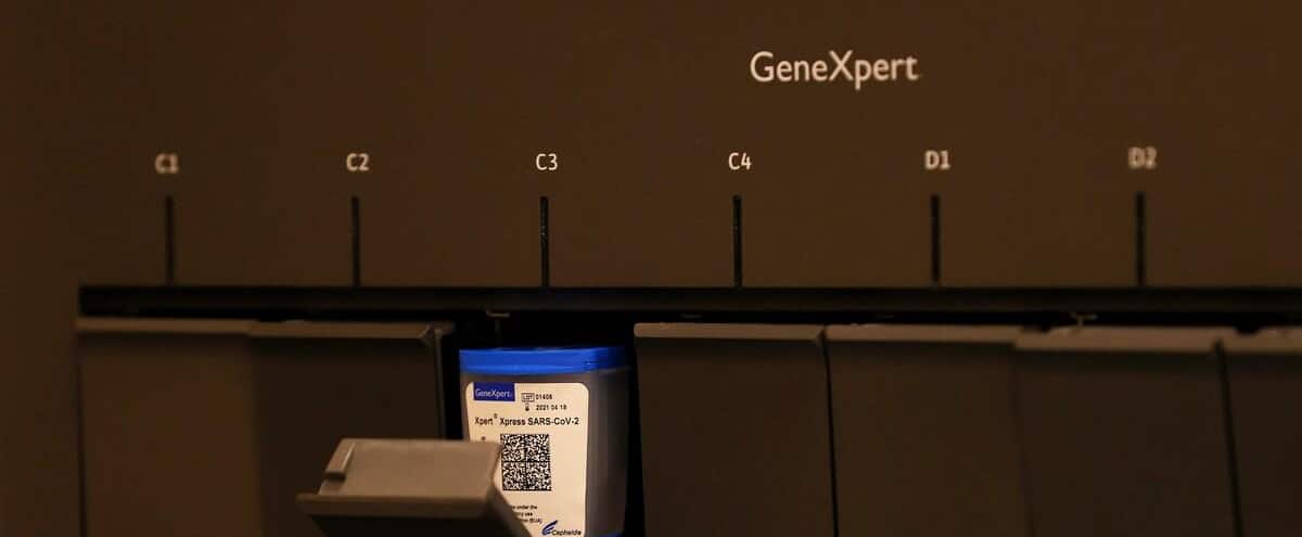 COVID-19: rapid tests have arrived in Quebec 1