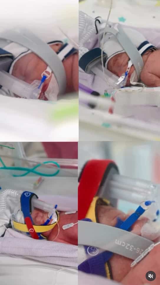 Identical quadruplets born from the same placenta: &ldquo;one chance in 15 million&rdquo;, estimates their doctor