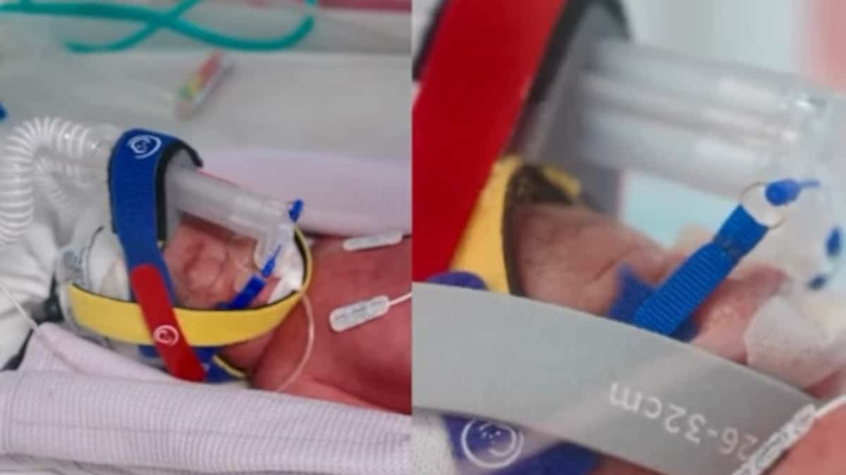 Identical quadruplets born from the same placenta: “one chance in 15 million”, estimates their doctor Identical quadruplets born from the same placenta: “one chance in 15 million”, estimates their doctor