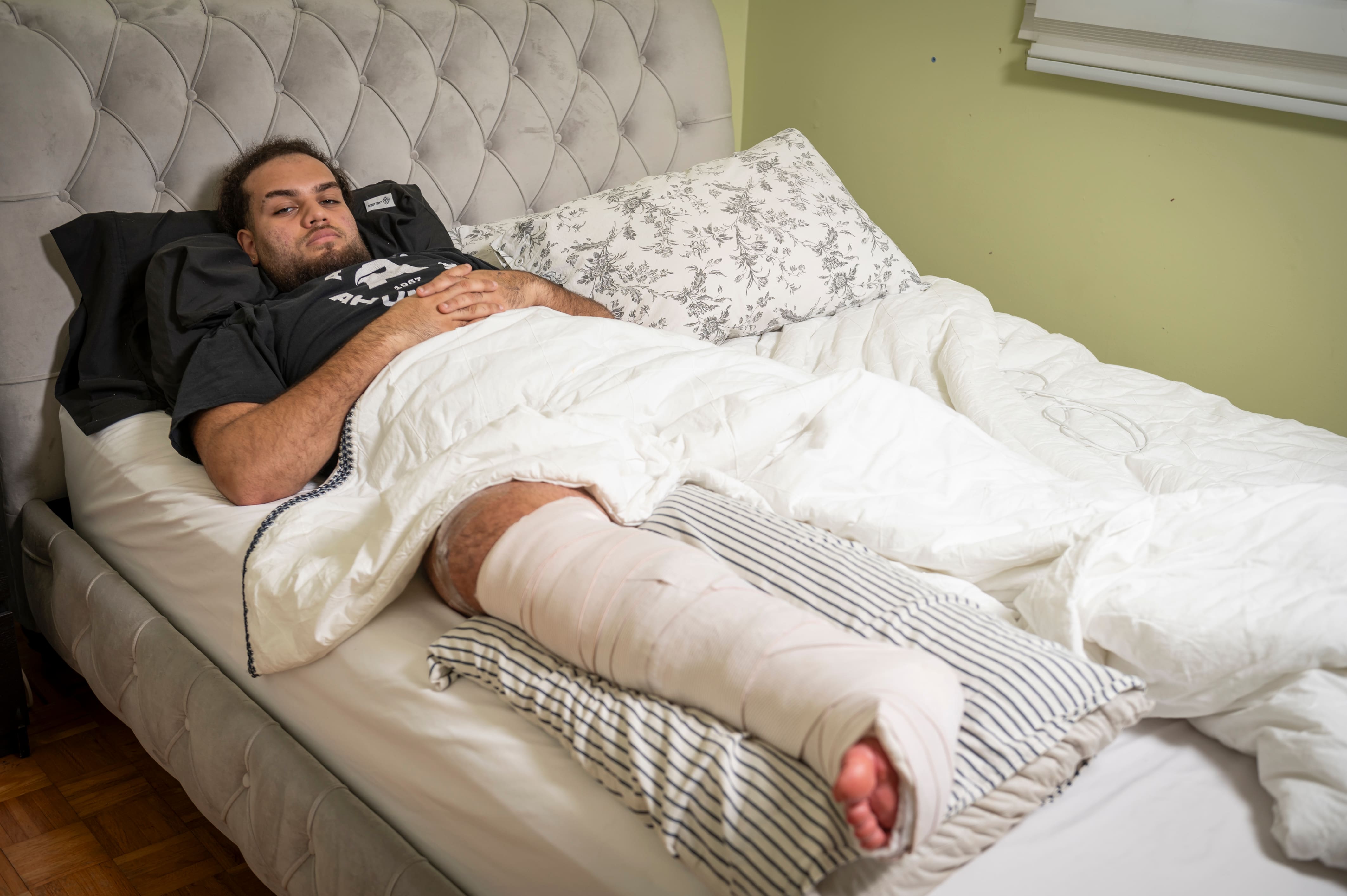 «C’était une torture pour lui»: un joueur de football avec une double fracture a dû attendre 95 minutes pour une ambulance, à Montréal