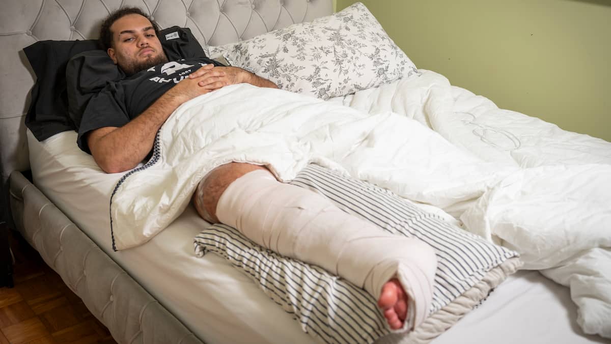 «C’était une torture pour lui»: un joueur de football avec une double fracture a dû attendre 95 minutes pour une ambulance, à Montréal