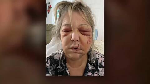 Accused of attempted murder, an angry snowmobiler must defend himself