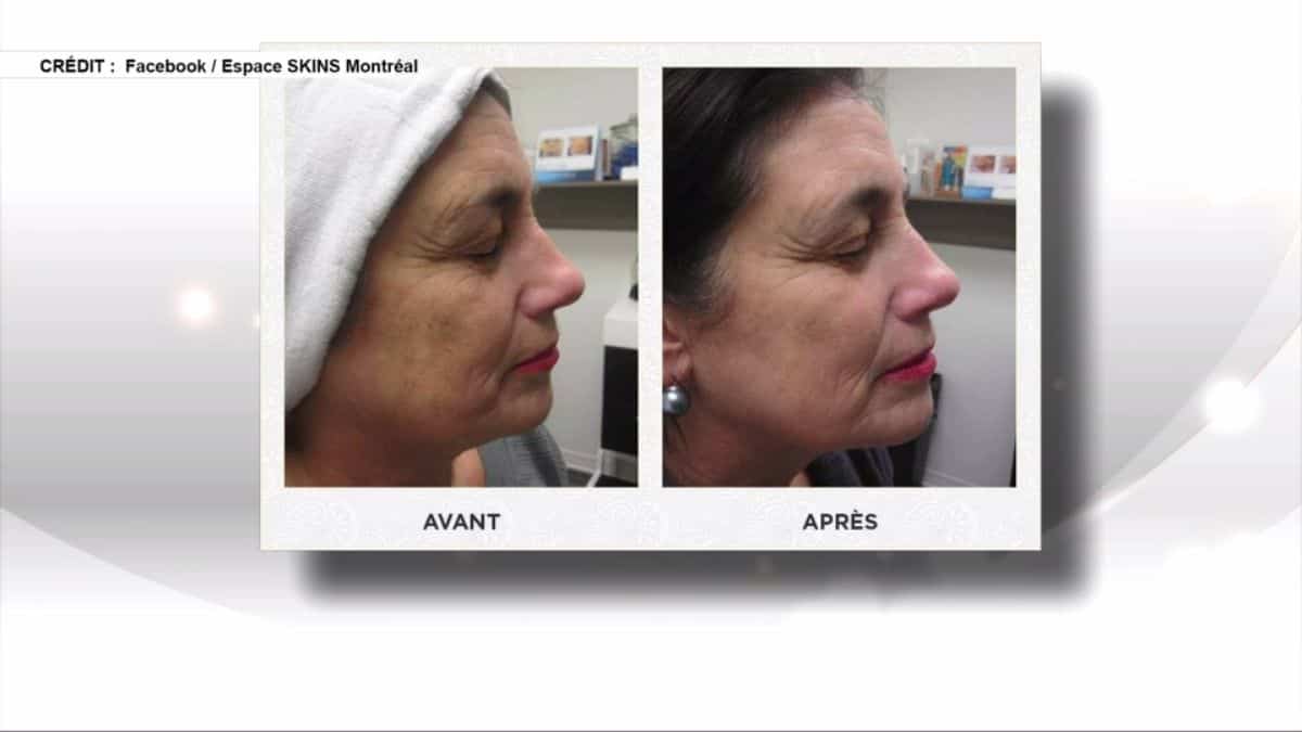 TENDANCES: 4 nouvelles technologies en beauté