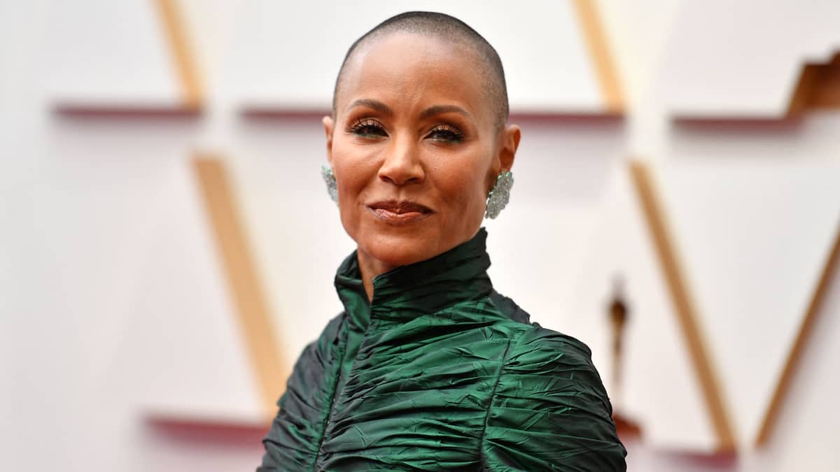 6 femmes célèbres confrontées à l’alopécie