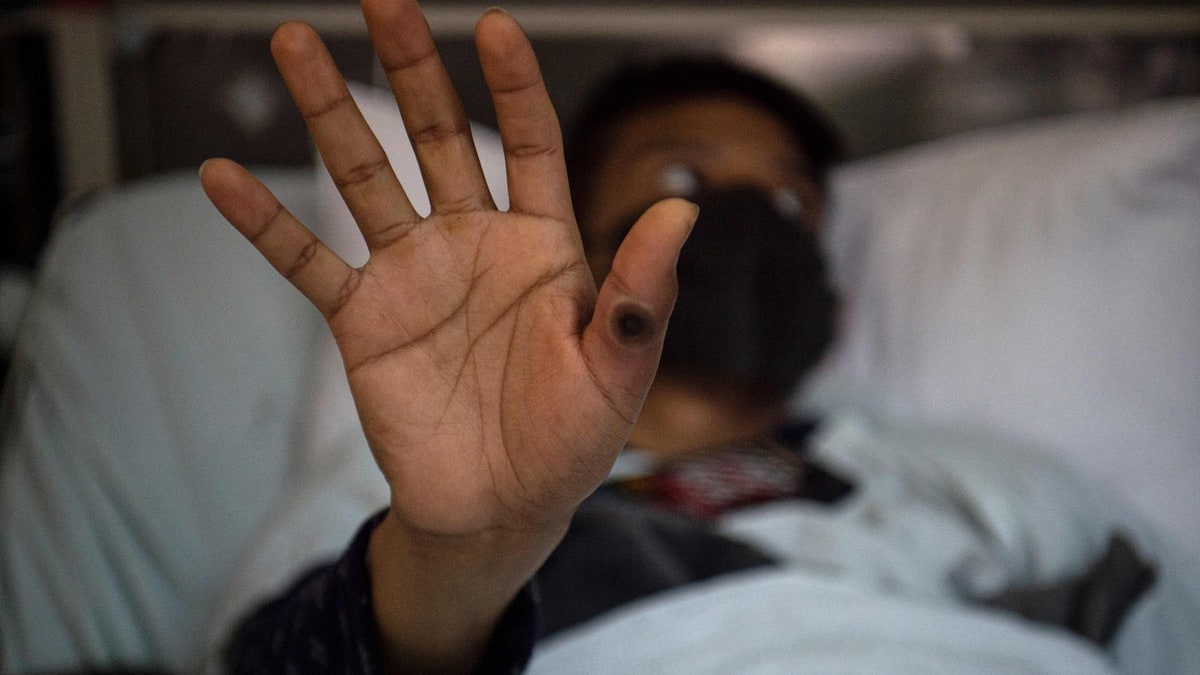 160% increase in smallpox cases in 2024: ‘Public health emergency’ declared in Africa 160% increase in smallpox cases in 2024: ‘Public health emergency’ declared in Africa