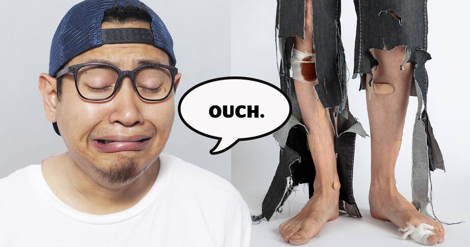 Image principale de l'article Ils racontent leur blessure «la plus stupide»
