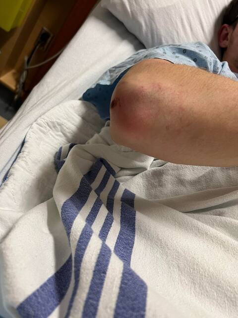 The complainant sustained multiple injuries after police intervention.