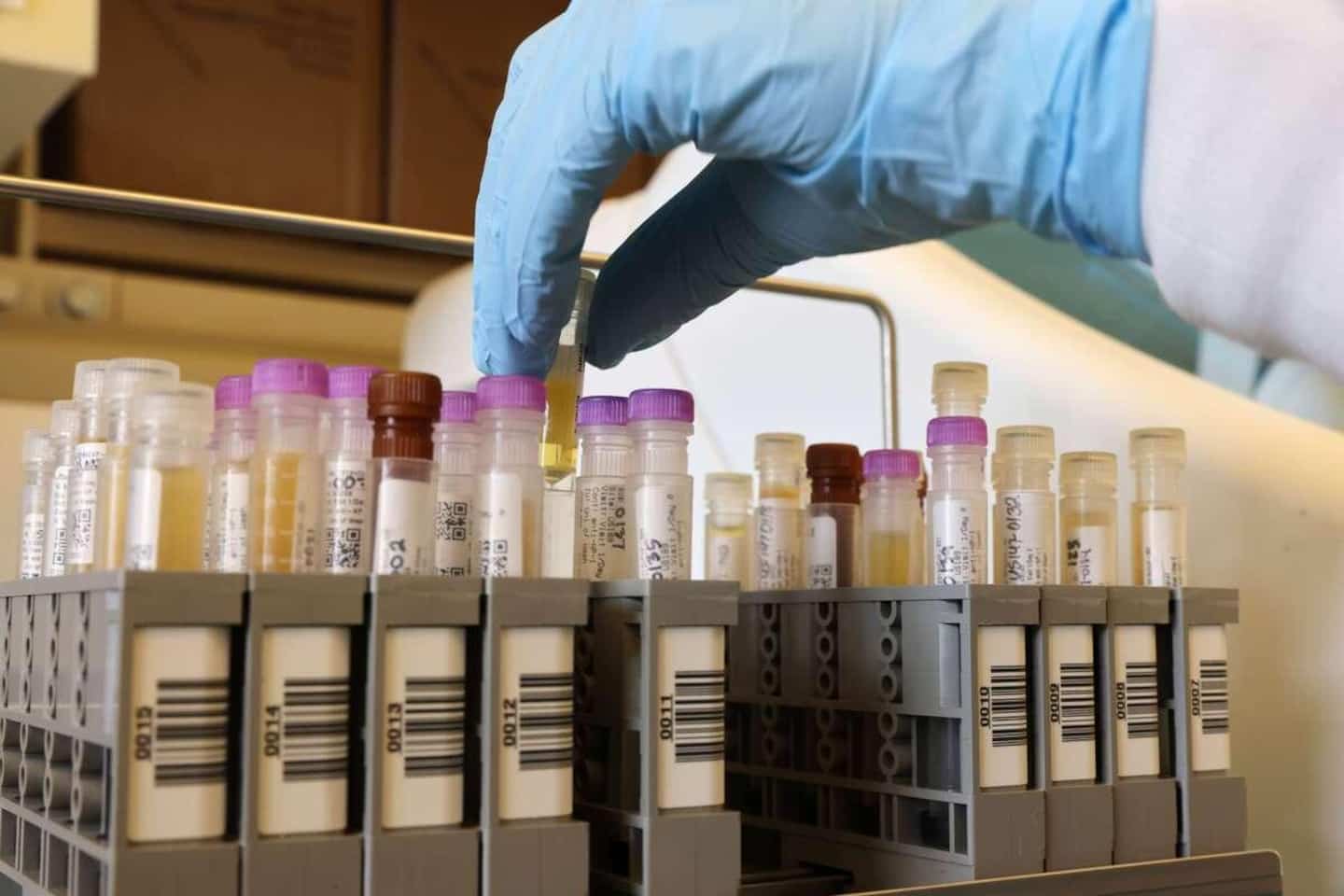 COVID-19: le Japon commande 150 millions de doses du vaccin de Novavax COVID-19: le Japon commande 150 millions de doses du vaccin de Novavax