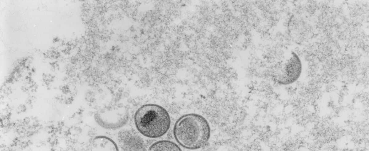 Gli Stati Uniti rafforzano la campagna di vaccinazione contro il vaiolo delle scimmie Gli Stati Uniti rafforzano la campagna di vaccinazione contro il vaiolo delle scimmie