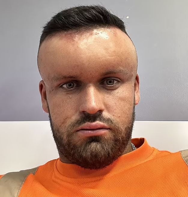 Sa t&ecirc;te se gonfle comme une montgolfi&egrave;re &agrave; cause d&rsquo;une teinture