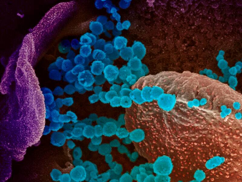 Cas de coronavirus en Colombie: mise à jour du 20 mars Cas de coronavirus en Colombie: mise à jour du 20 mars