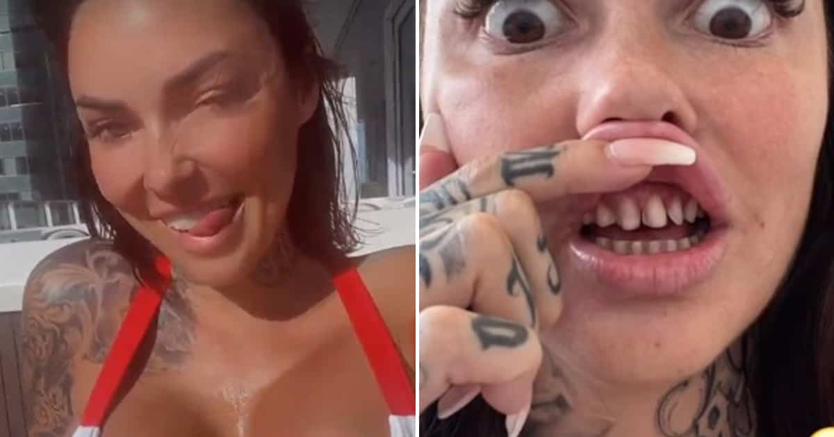 Image principale de l'article Elle s’est fait limer les dents et ça fait réagir
