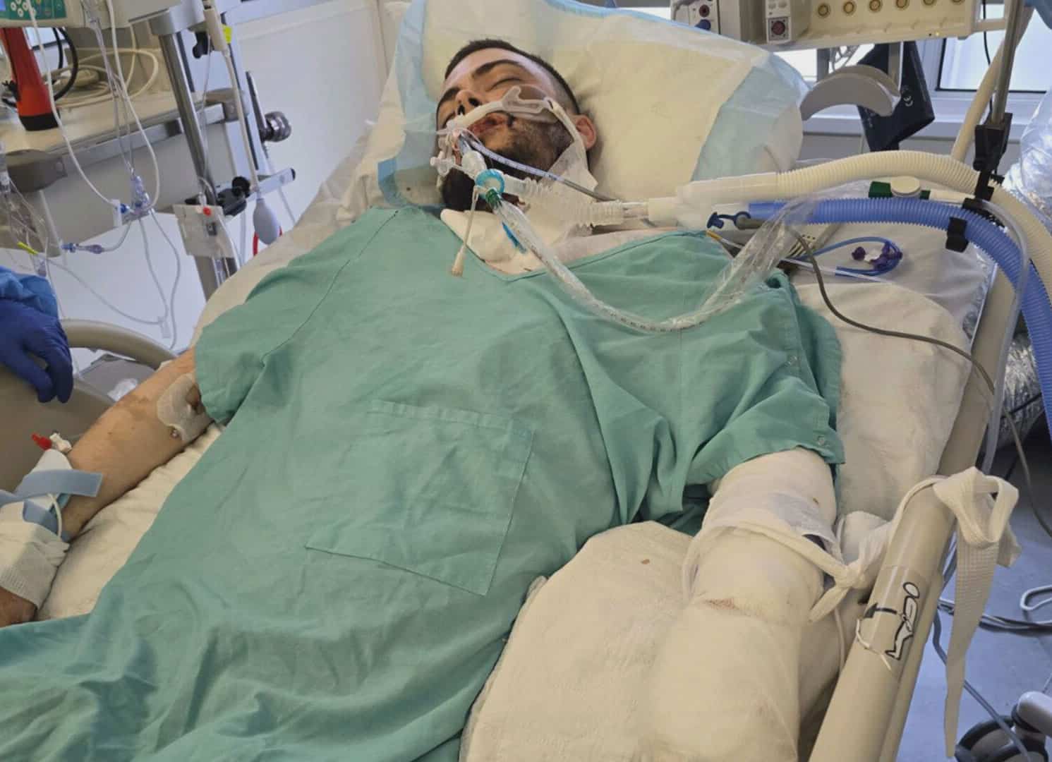 &laquo;Il ne m&eacute;ritait pas ce qui lui est arriv&eacute;&raquo;: un pr&eacute;sum&eacute; voleur de voiture gravement bless&eacute; durant une intervention polici&egrave;re