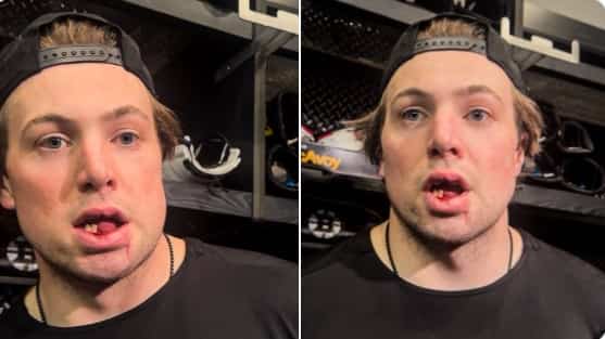 L'homme le plus magané de la LNH cette saison joue encore de malchance