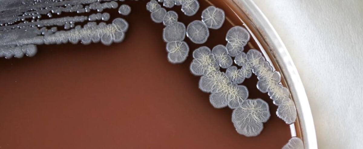 A bacteria that causes a serious infectious disease has been discovered in the United States A bacteria that causes a serious infectious disease has been discovered in the United States