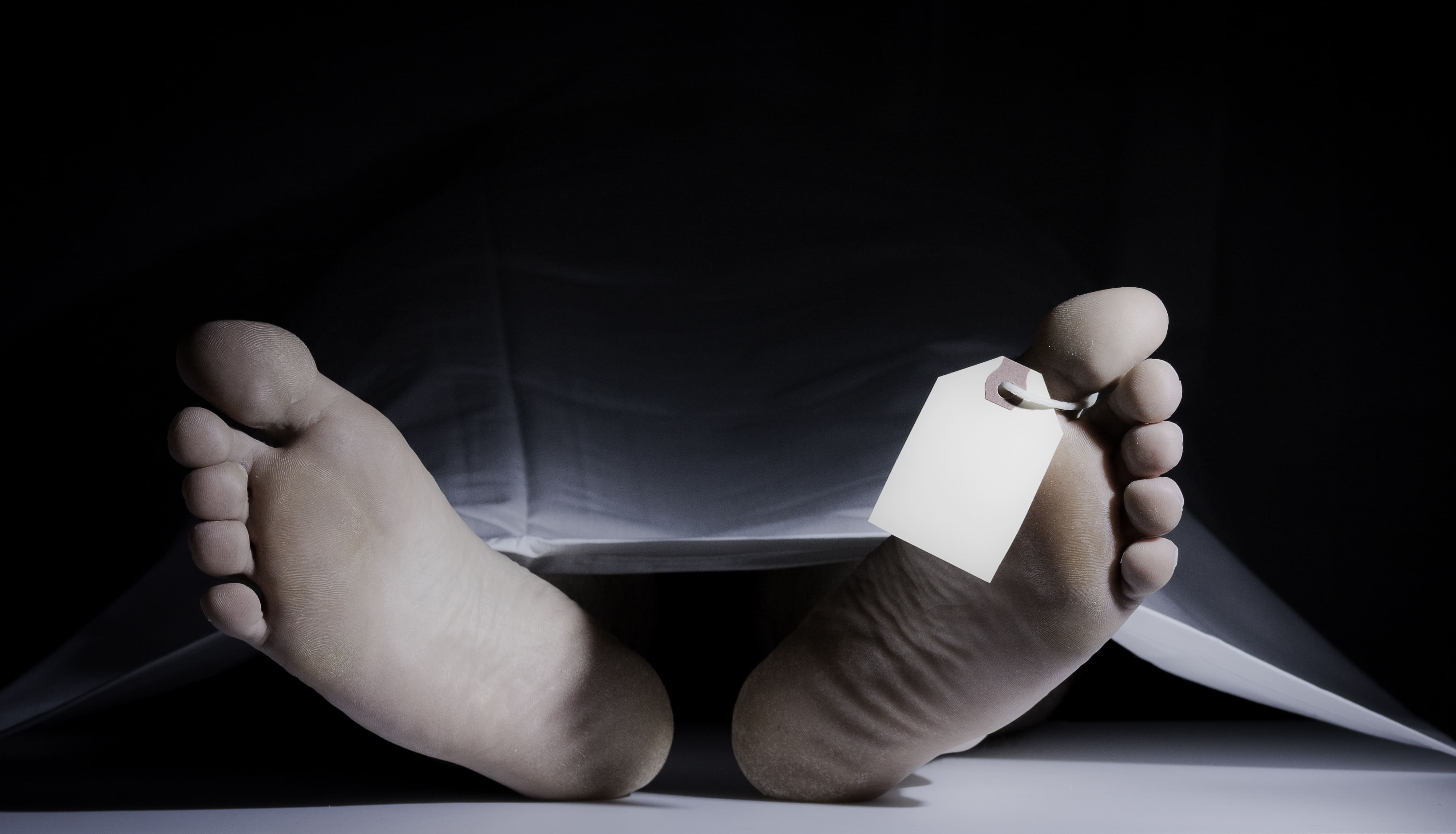 Une d&eacute;monstration publique d'autopsie &agrave; 500 dollars la place fait pol&eacute;mique aux &Eacute;tats-Unis