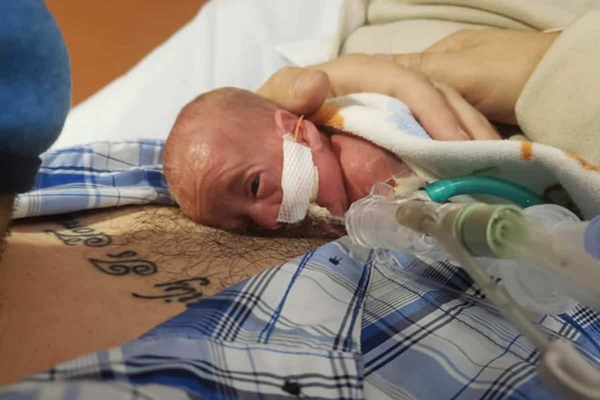 En Images Le Plus Jeune Premature Au Monde Fete Son Premier Anniversaire Jdm En Images Le Plus Jeune Premature Au Monde Fete Son Premier Anniversaire Jdm