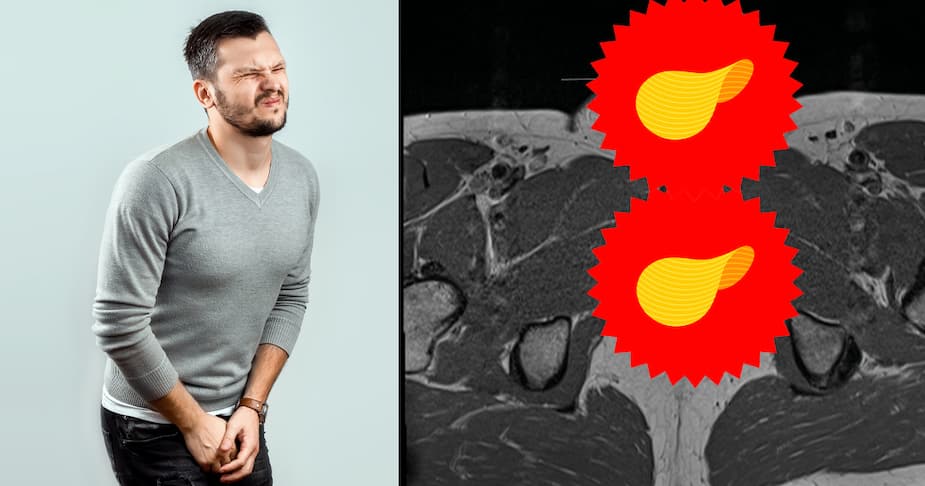 Image principale de l'article Un homme s'est brisé le pénis verticalement