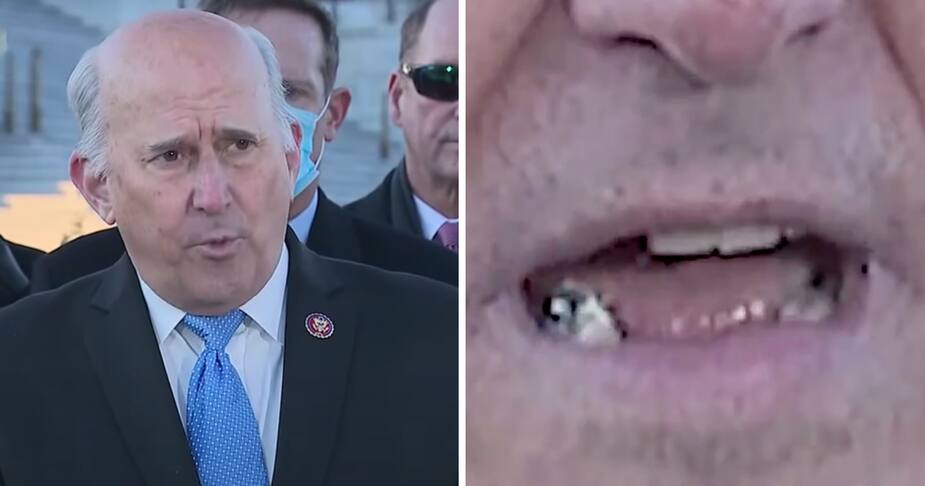 Image principale de l'article Un politicien américain perd une dent en direct