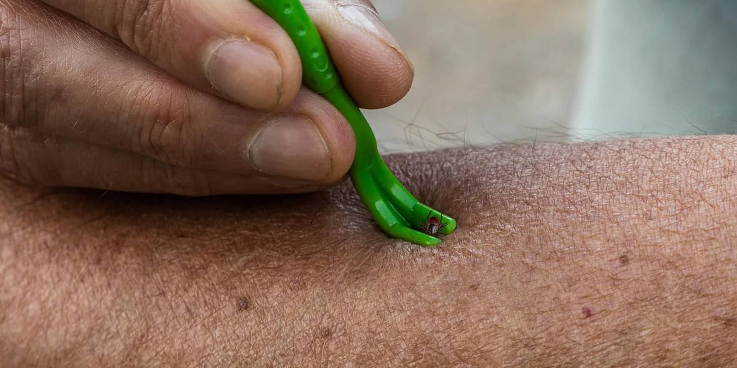 Que faire en cas de morsure de tique?