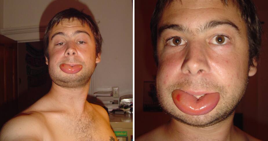 Image principale de l'article Il a un visage difforme pour une raison ridicule