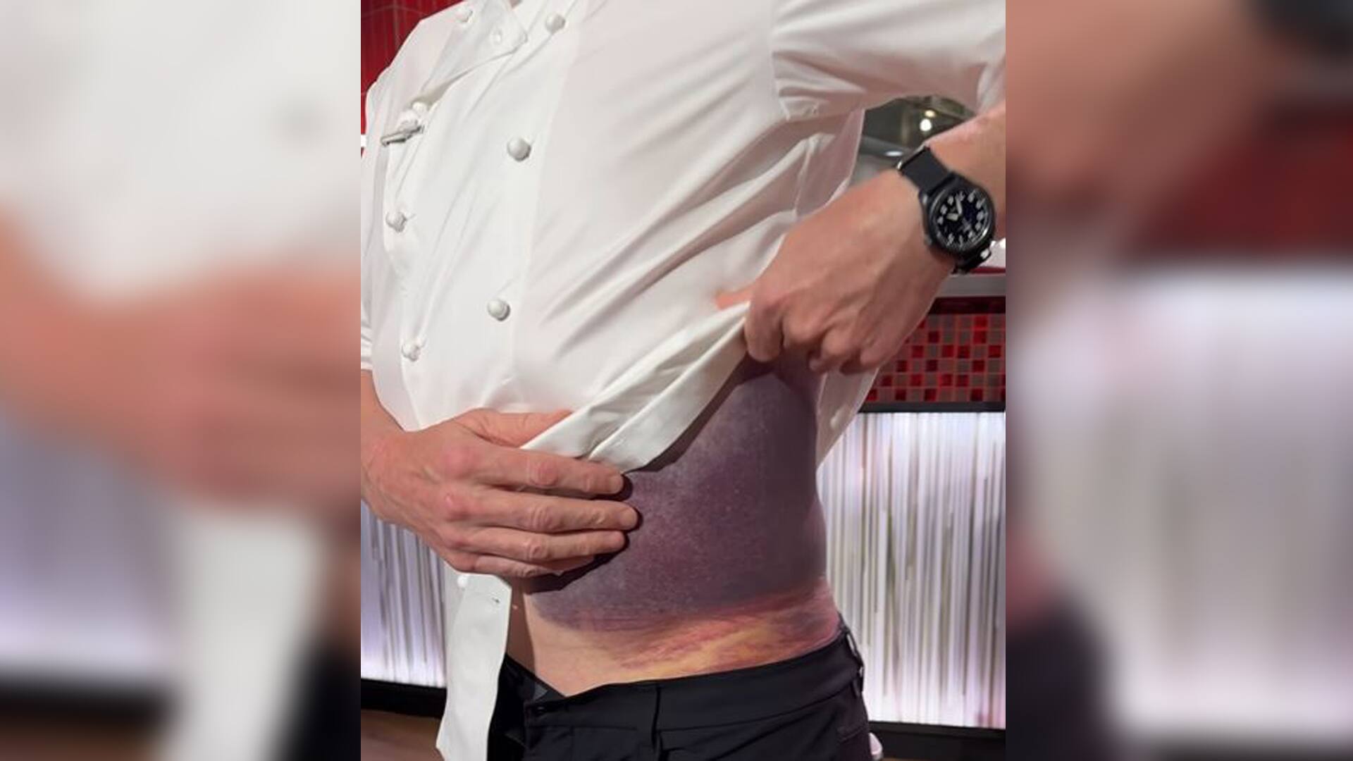 Gordon Ramsay &laquo;chanceux d&rsquo;&ecirc;tre en vie&raquo; apr&egrave;s un accident en v&eacute;lo