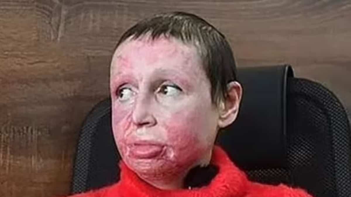 Russian man who crucified girlfriend, set her on fire, escapes prison by joining Putin's army Russian man who crucified girlfriend, set her on fire, escapes prison by joining Putin's army