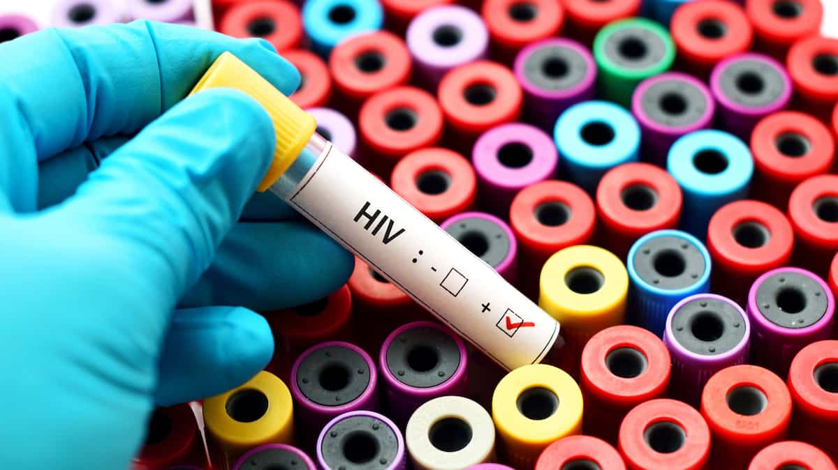 VIH: nouvelle avancée par des chercheurs de l’INRS | TVA Nouvelles